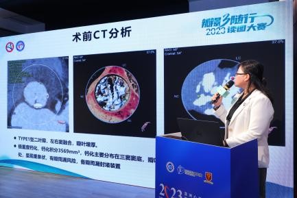 20231222140150322397215 20231222140150322397215