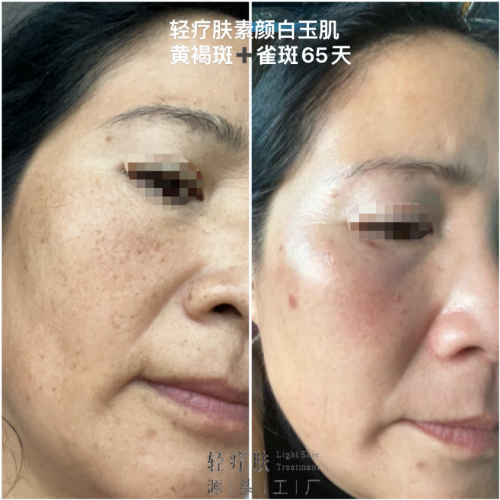 6746e5bec218a 6746e5bec218a