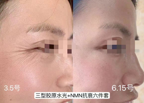 6746e5bf1aa49 6746e5bf1aa49